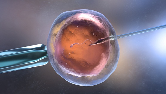 fecundación in vitro Túnez