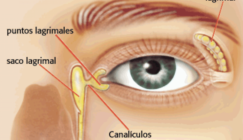 Dacriocistorrinostomía 