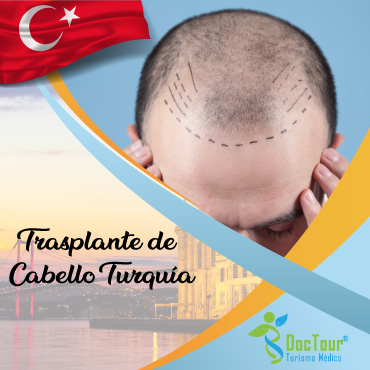 implante capilar turquía